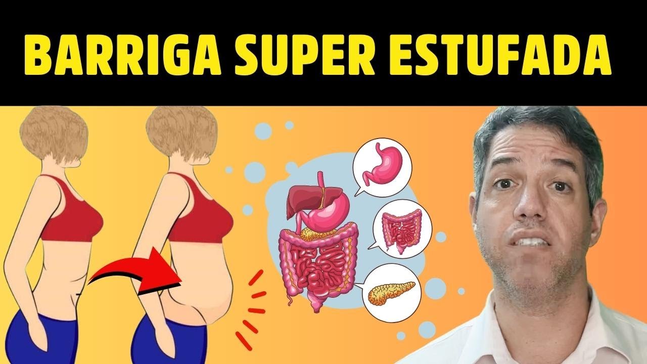 10 CAUSAS de BARRIGA ESTUFADA e GASES (descubra a causa do Inchaço na sua barriga) Dr. Alain Dutra