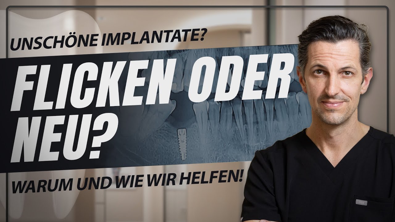 Implantate unansehnlich? Essen klemmt? Schau, warum und entdecke die Lösung!