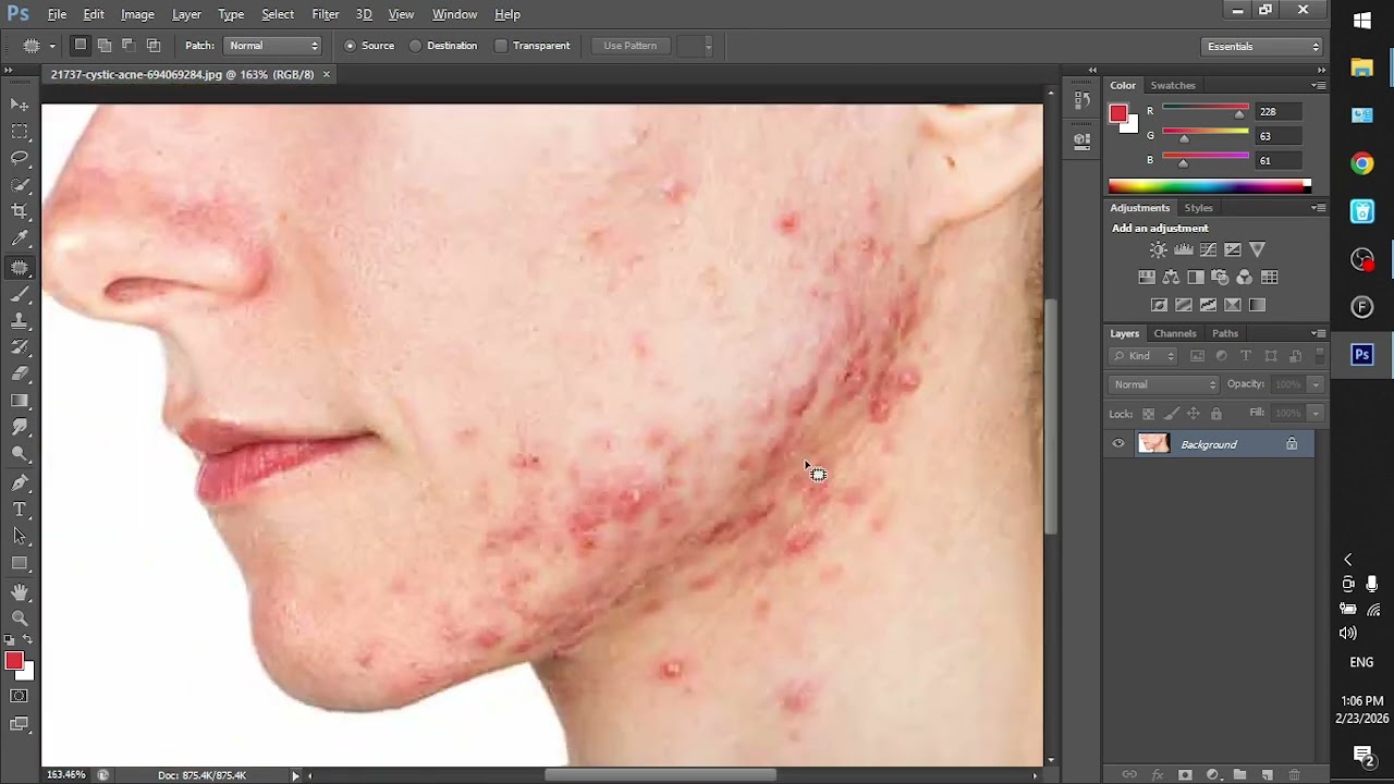 1 Photoshop: Clearing Pimples with Healing Spot Tool