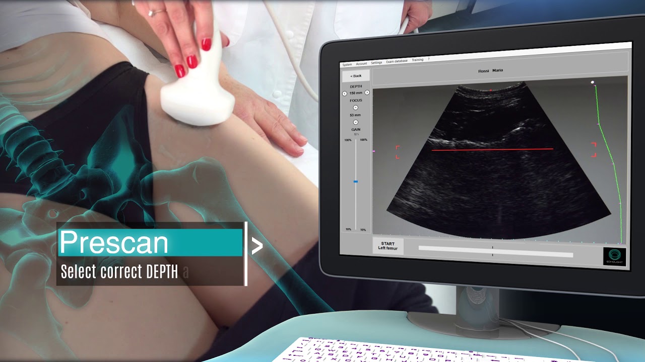 Echolight Demo Femur Scan