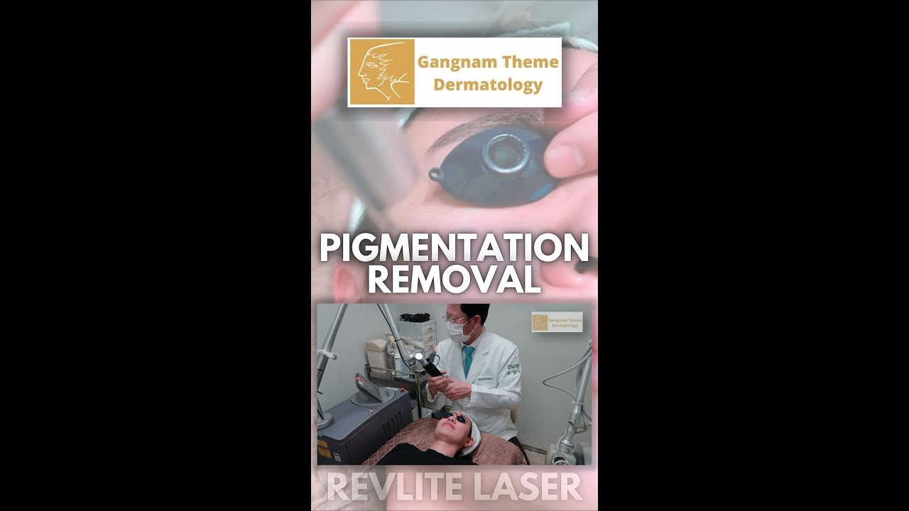 Theme Dermatology - Pigmentation Removal