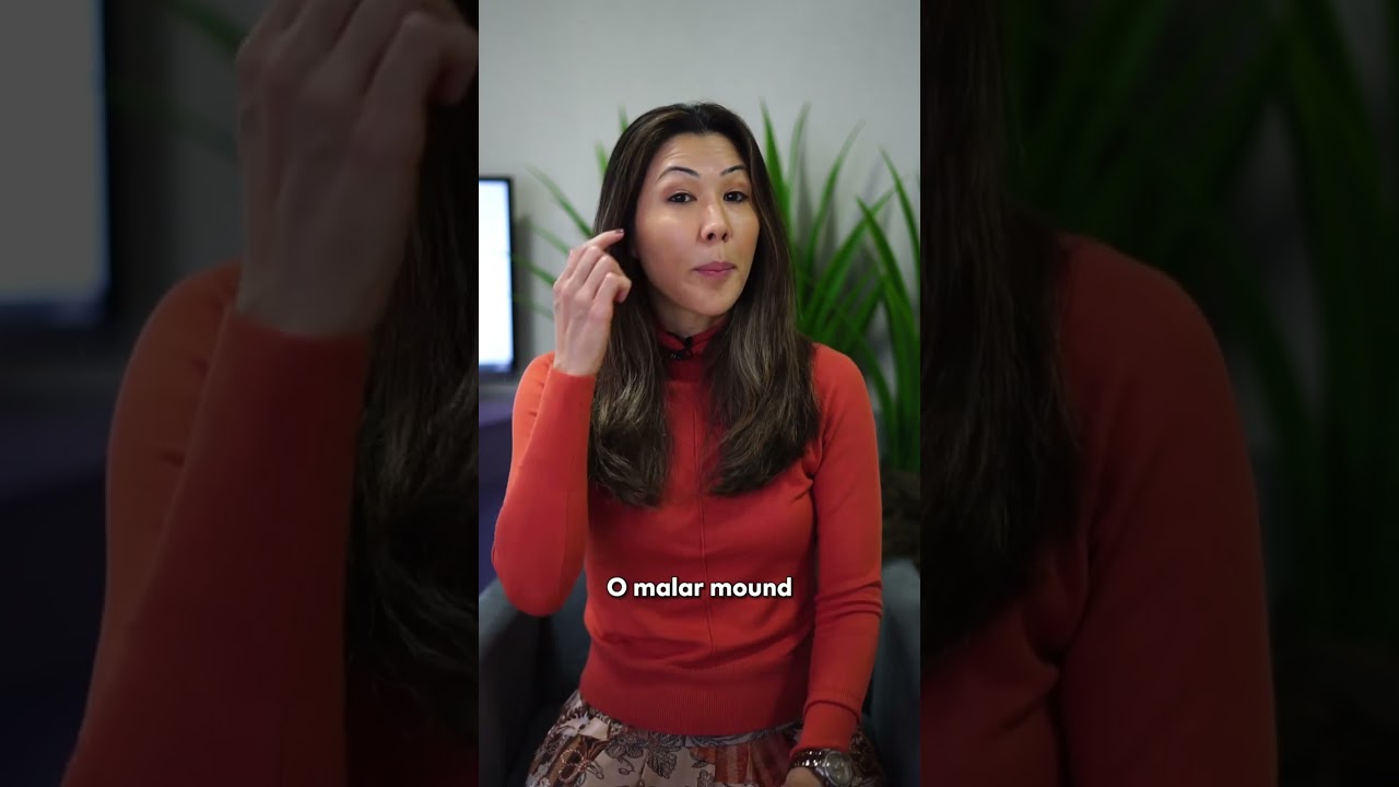 A blefaroplastia resolve o edema malar?