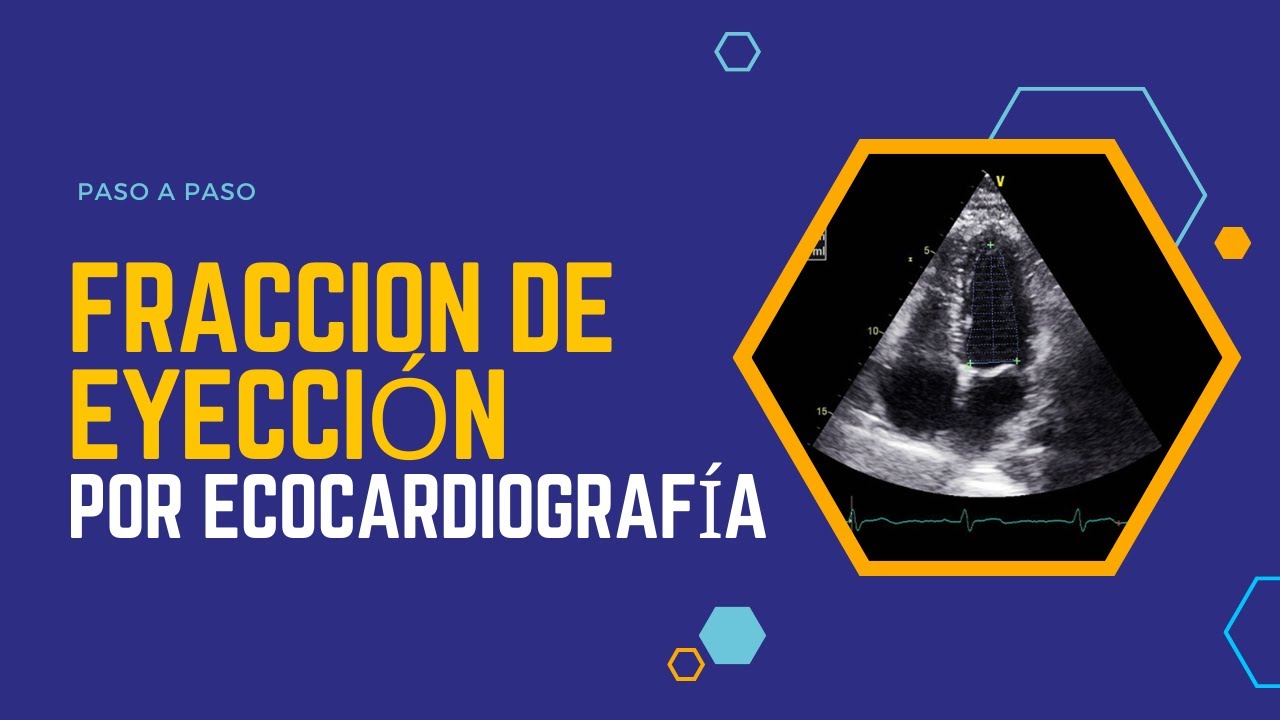✅FRACCIÓN DE EYECCIÓN (FEVI) por ecocardiografía. PASO A PASO.