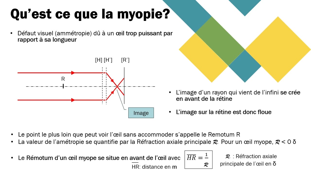 La myopie