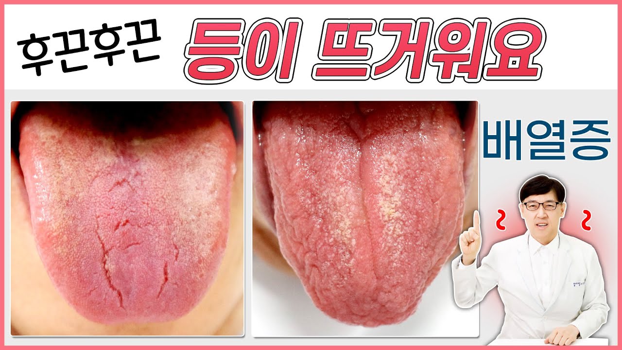 등에서 열이 나는 이유 뭔가요? 배열증 원인과 치료방법