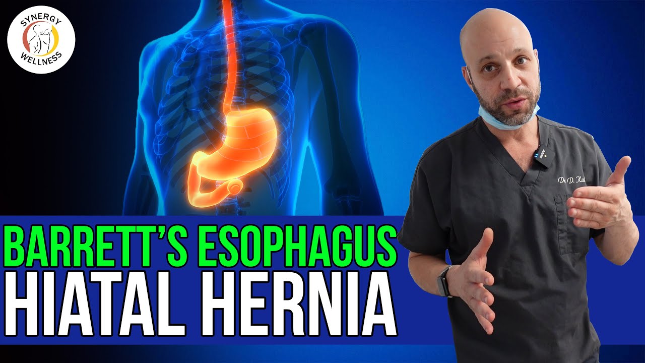 Patient with Barrett’s Esophagus and Hiatal Hernia