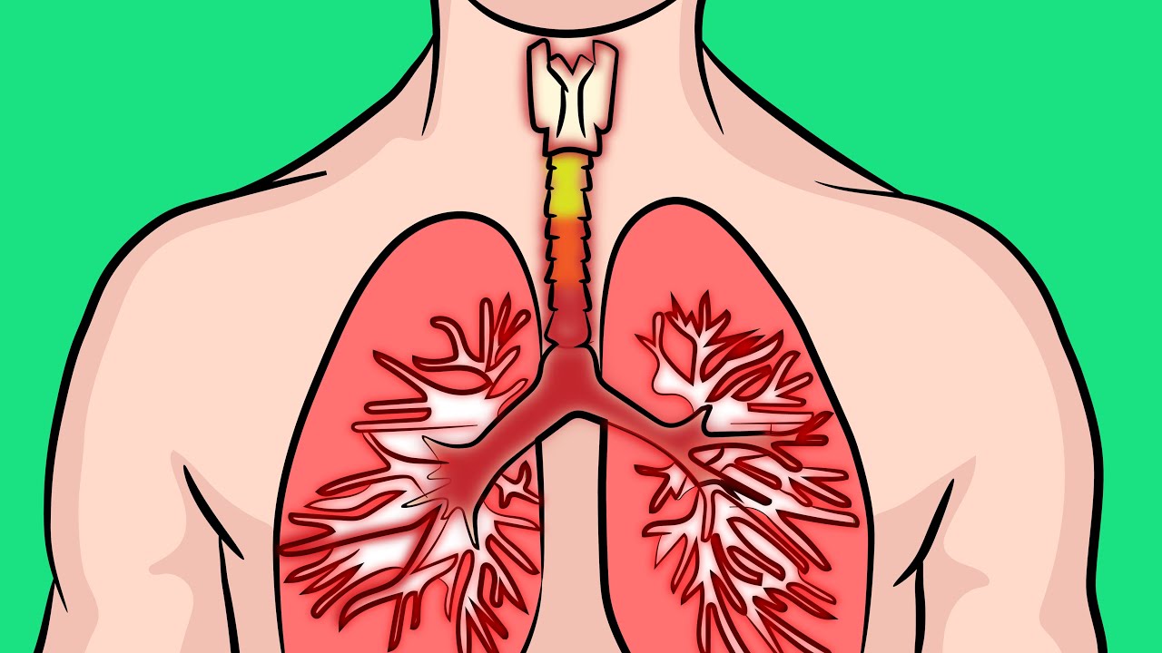 How to naturally breathe better if you have chronic bronchitis!