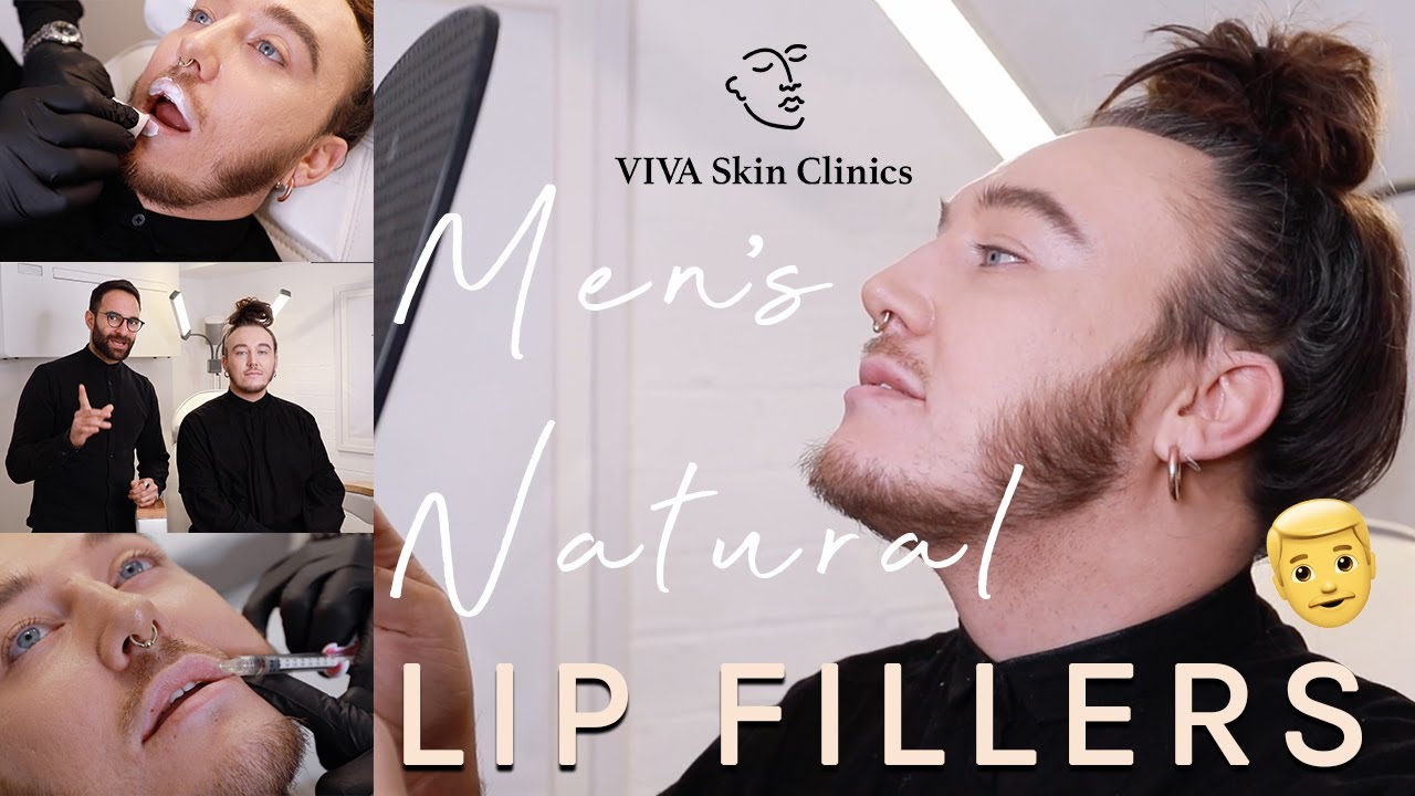 Men's Natural-Looking Lip Fillers London | VIVA Skin Clinics