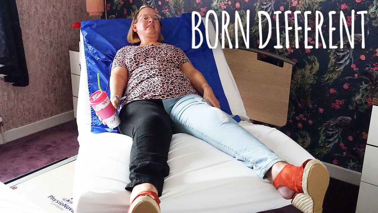 The Woman Who's Turning To Stone | BORN DIFFERENT
