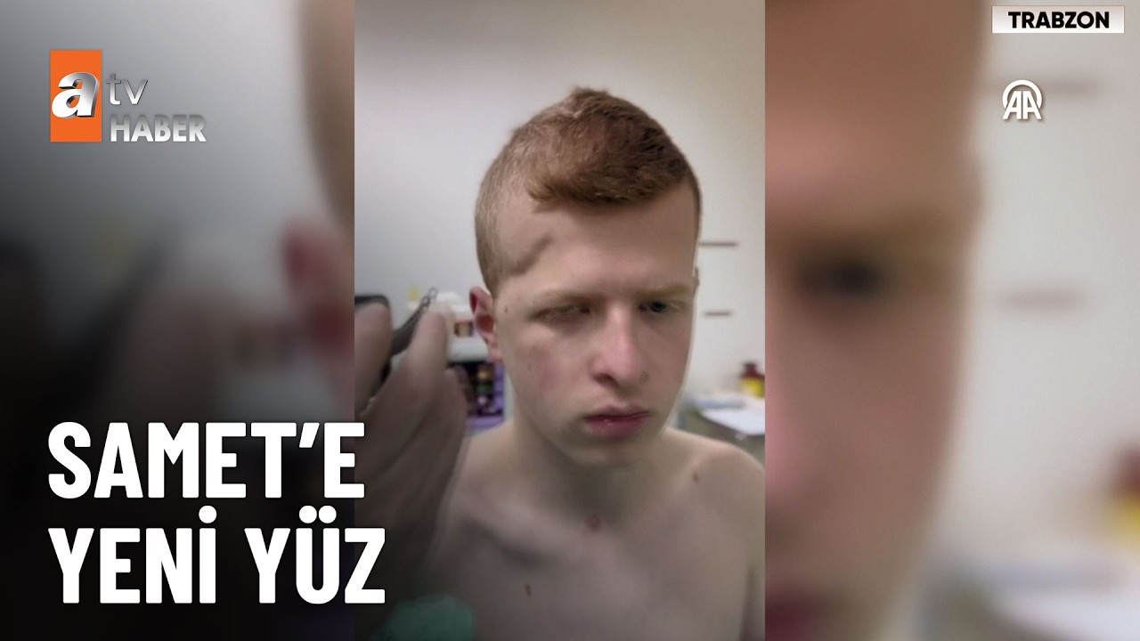 3 boyutlu modelleme estetiği sayesinde yeni y&uuml;z&uuml;ne kavuştu - atv Haber 14 Nisan 2026