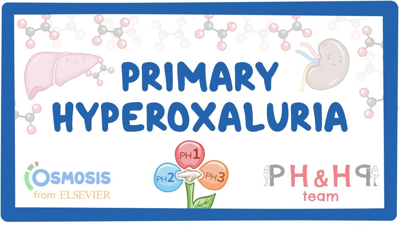 Primary hyperoxalurias - causes, symptoms, diagnosis, treatment, pathology