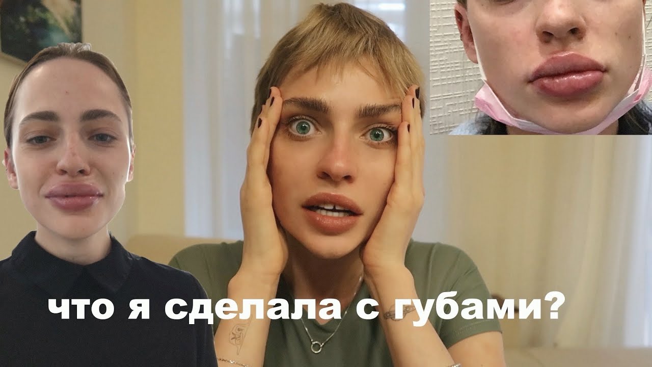 НАКАЧАЛА ГУБЫ...ужасные последствия  |  моя история