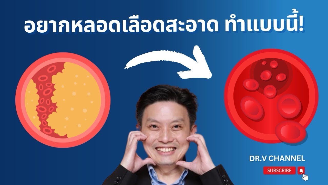 ทำเดี๋ยวนี้ เพื่อหลอดเลือดคุณ!