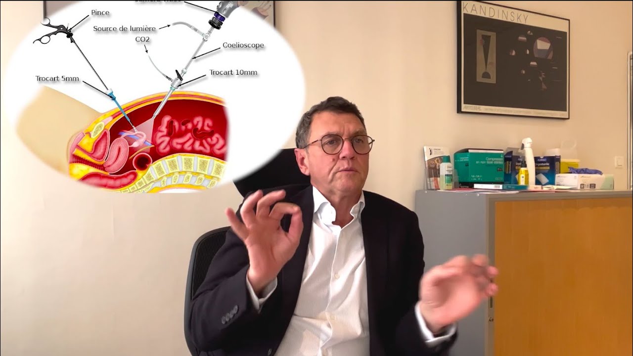 Mars Bleu : les traitements du cancer du colon - Interview du Dr. Chiche