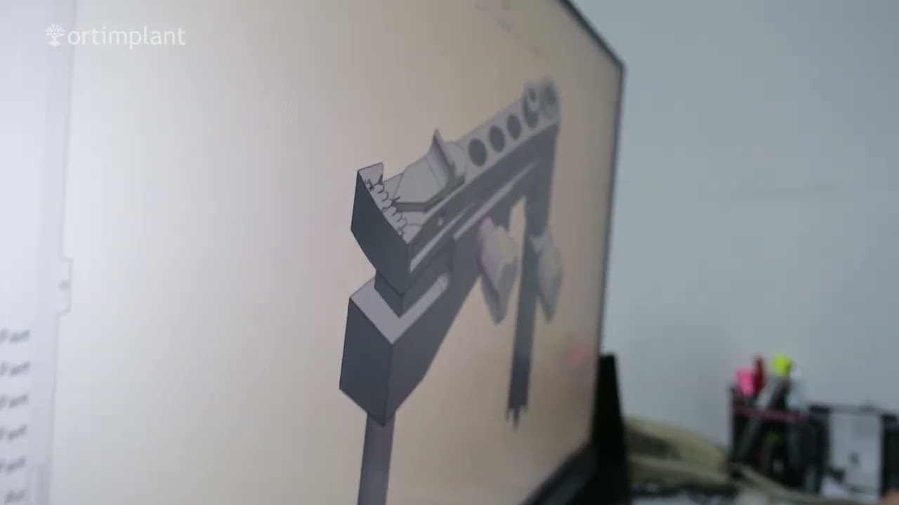 Ortimplant R&D Design Process #orthopedie #researchanddevelopment