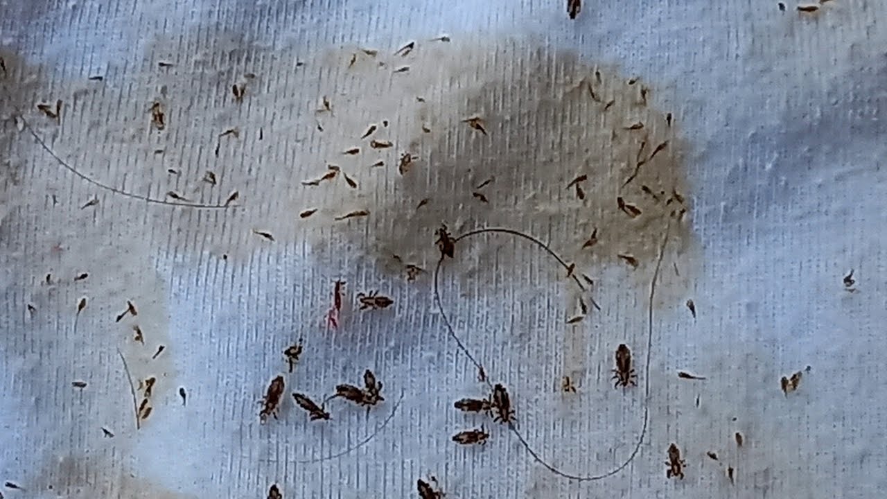 TIRANDO PIOLHO E LÊNDEAS COM PENTE E LINHA