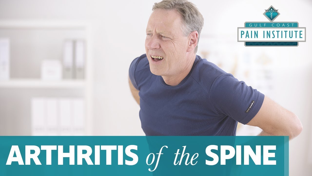 Treatment for Arthritis of the Spine
