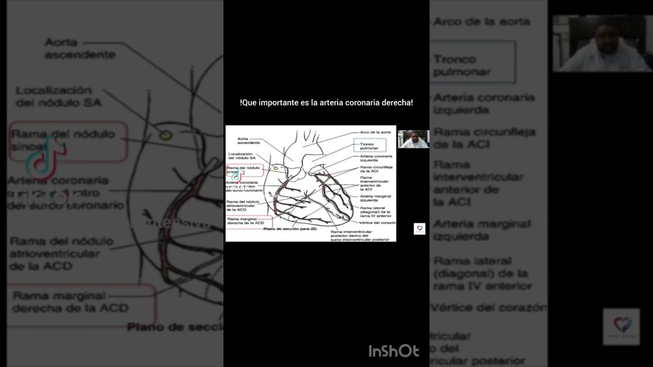 Arteria coronaria derecha