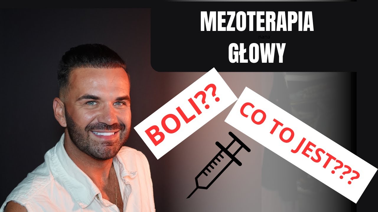Mezoterapia głowy - boli? Warto? UWAGA KREW! 🔴