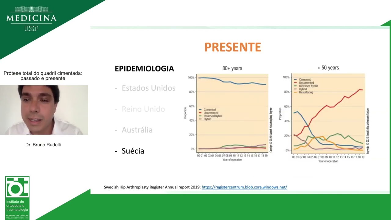 Pr&oacute;tese total do quadril cimentada: passado e presente - Dr. Bruno Rudelli
