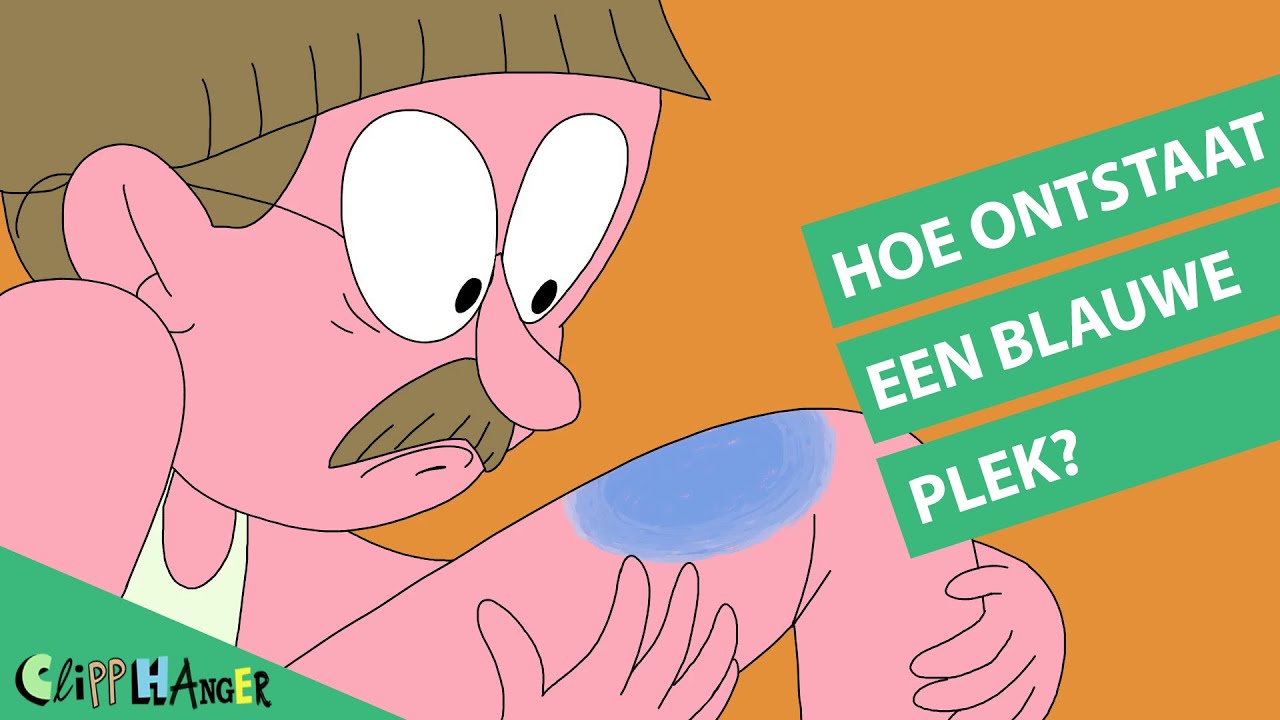 Hoe ontstaat een blauwe plek?