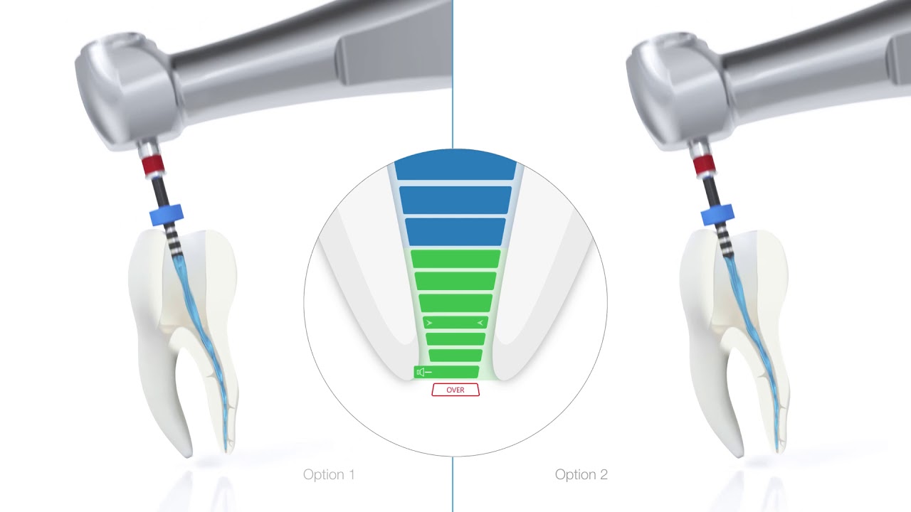 VDW Dental · Инструкция: VDW.ROTATE - пошаговая инструкция