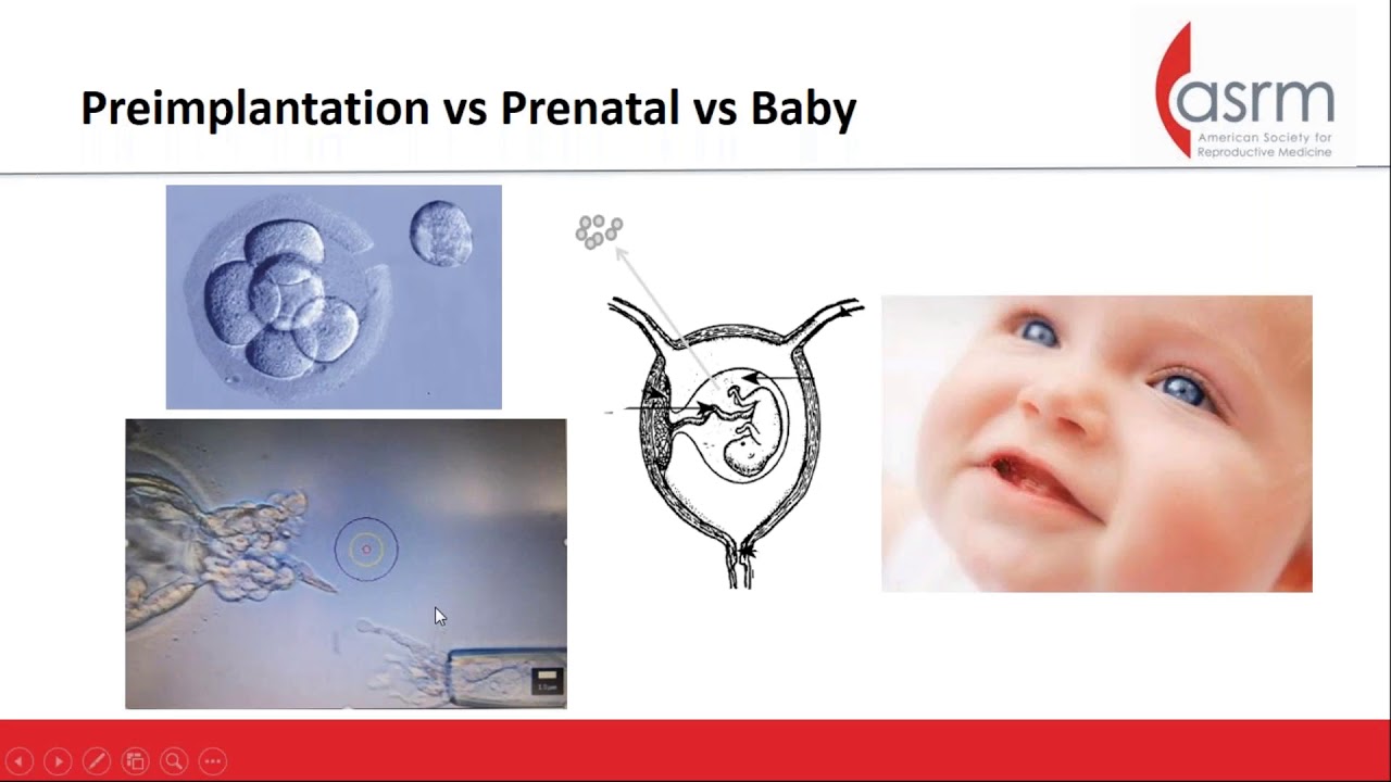 Ethics Webinar: Transferring Abnormal Embryos After Preimplantation Genetic Testing