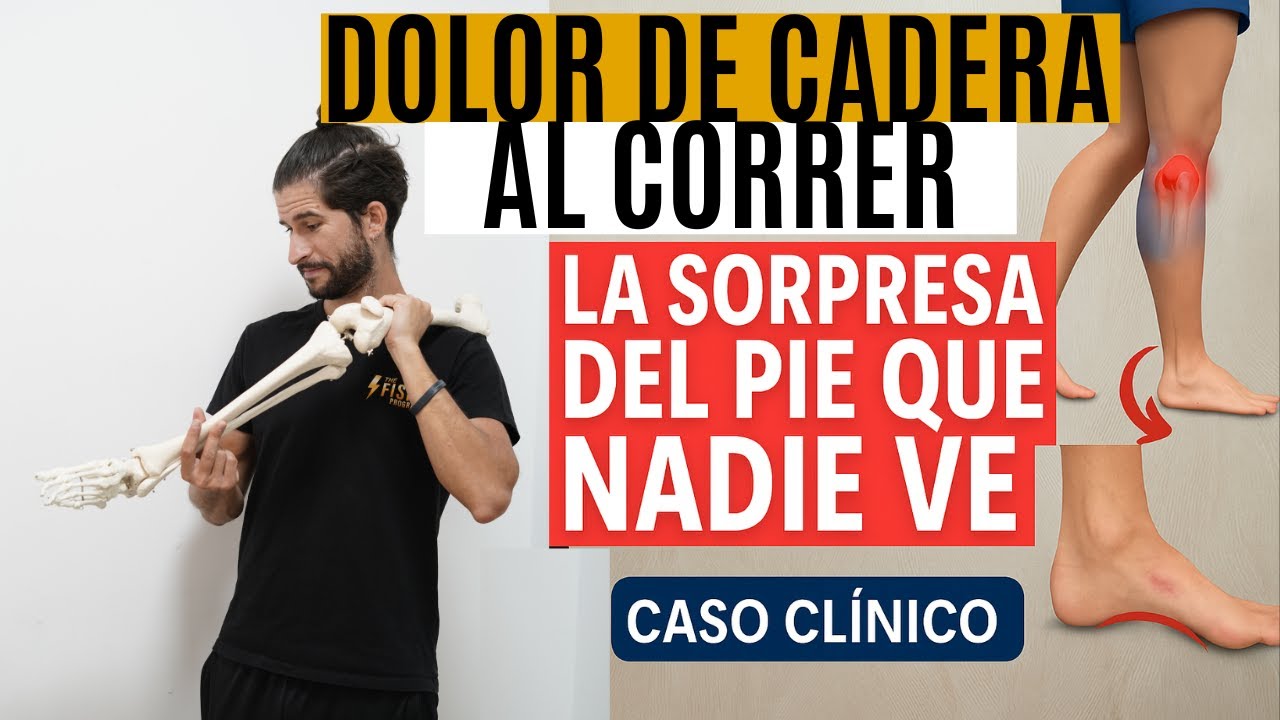 Dolor de cadera al correr: la sorpresa del pie que nadie ve | Caso clínico fisioterapia