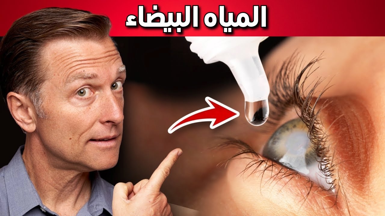علاج طبيعي للمياه البيضاء أو اعتام عدسة العين
