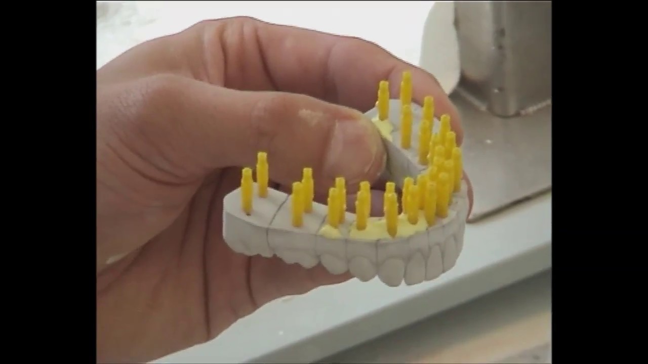 DTC / Herstellung Pin - Sägemodell - Splitcast - SAM
