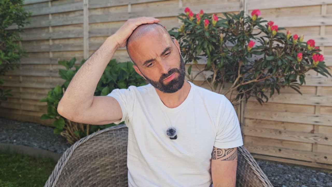 Je regrette mes greffes de cheveux ?