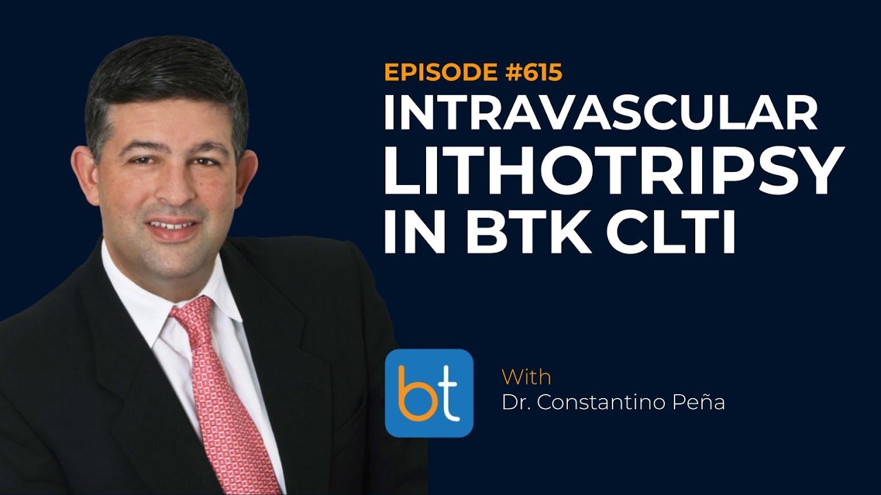Exploring Intravascular Lithotripsy in Below the Knee CLTI w/ Dr. Constantino Peña | Ep. 615