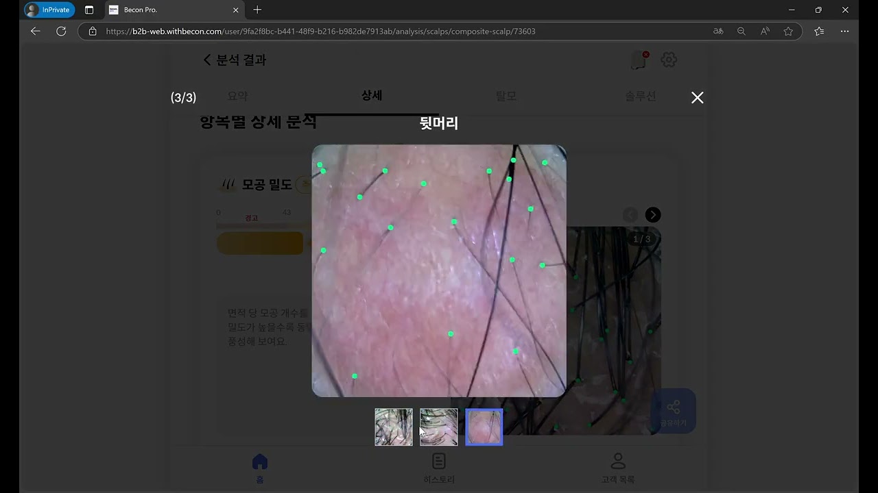 AI 두피.탈모.피부 스캐너 비컨:두피 종합 분석 활용법. 업데이트 내용도 함께 올려 드립니다.