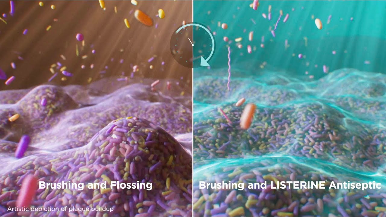 LISTERINE&reg; Antiseptic | 4.6x Greater Supragingival Plaque Reduction Than Flossing