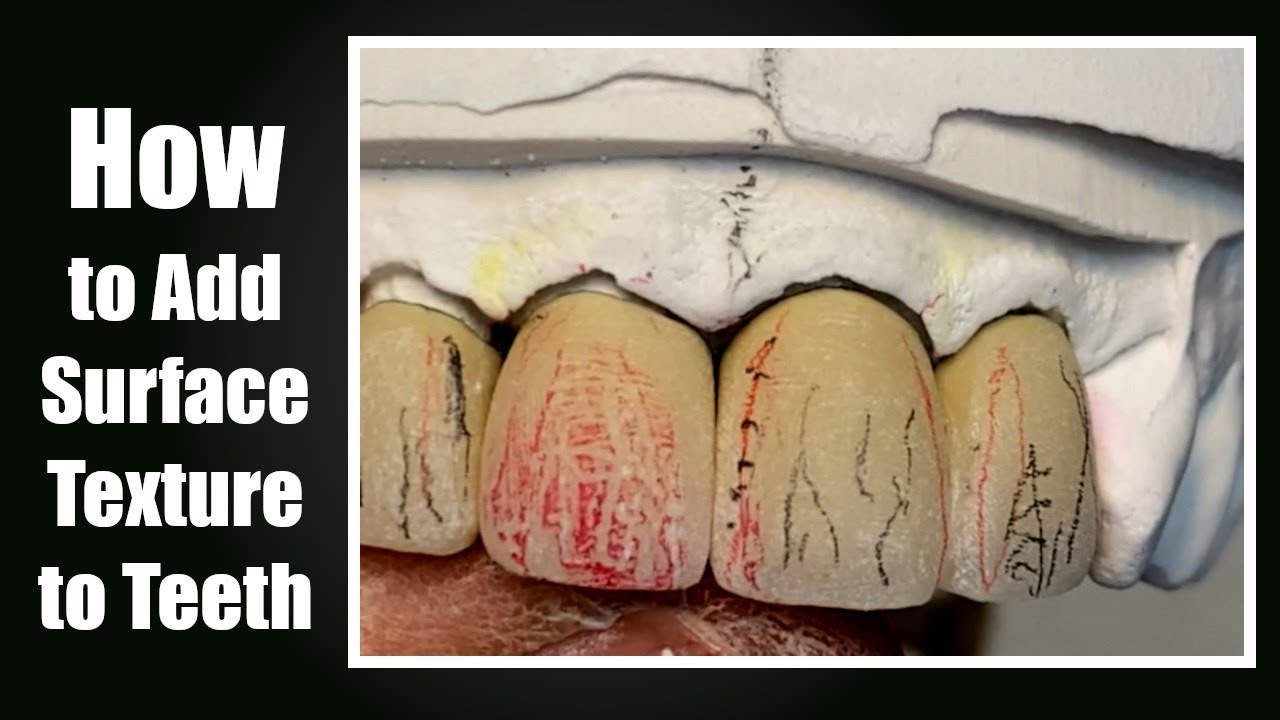 How to Add Surface Texture to Prosthetic Teeth