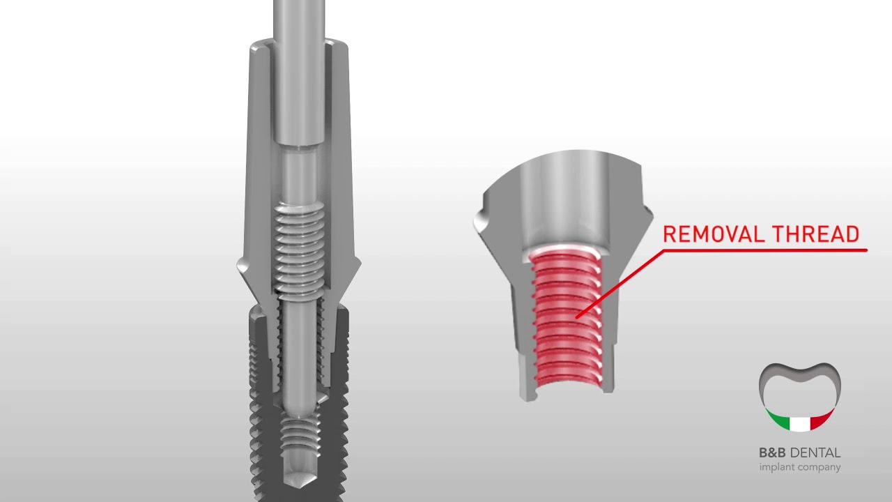B&B Dental | extraction tool