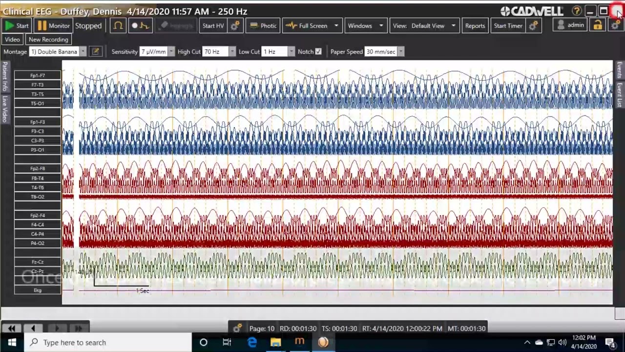 Step 9: How to use HL7 with Arc EEG software