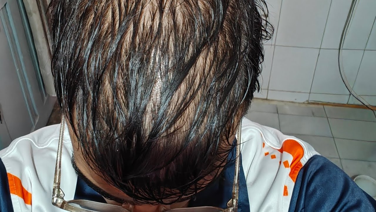 I'm LOOSING MY HAIR, Mai GUNJA Ho Raha hu