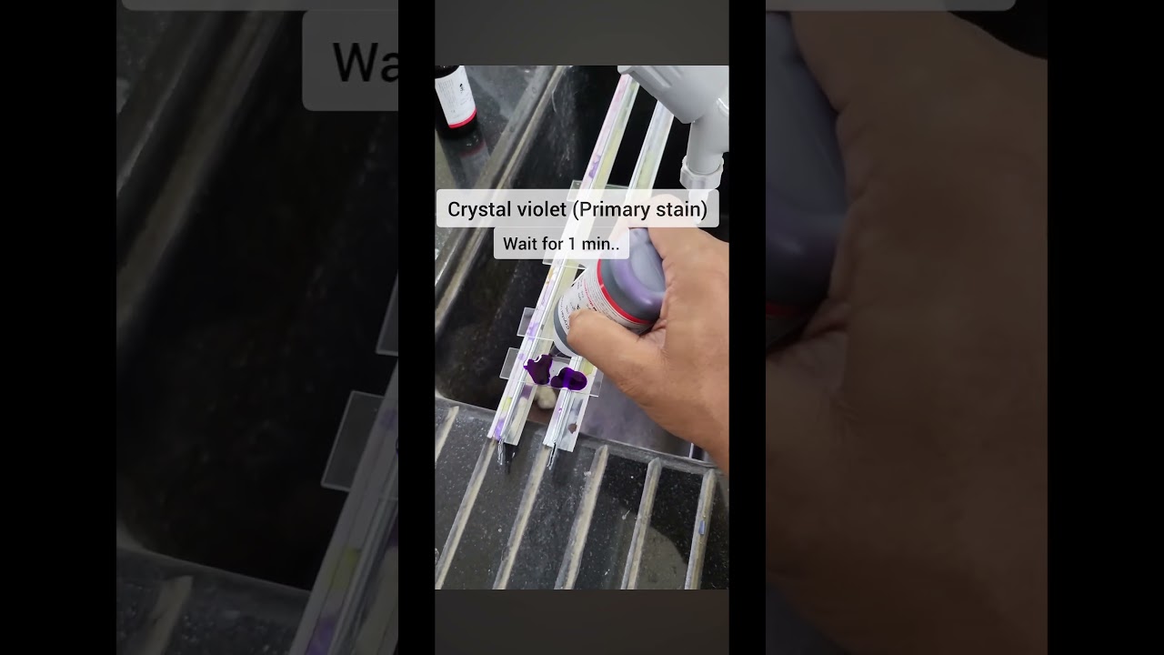 Gram staining procedure🧫
