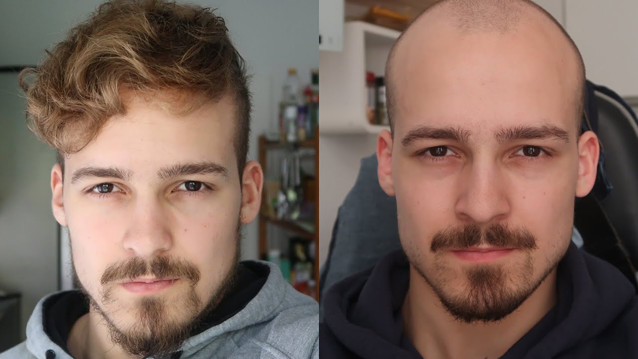 Glatze mit Anfang 20 | Meine Erfahrung mit Vorurteilen! | 