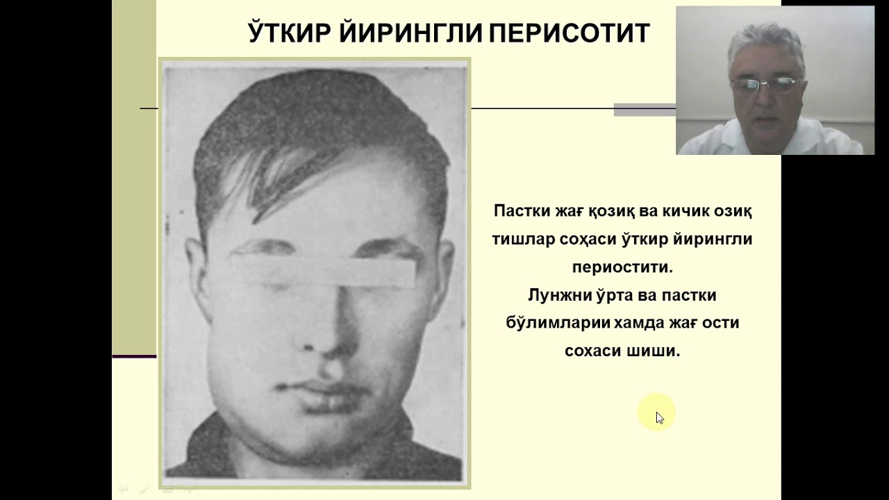 Юз жағ соҳасининг яллиғланиш касллаклари