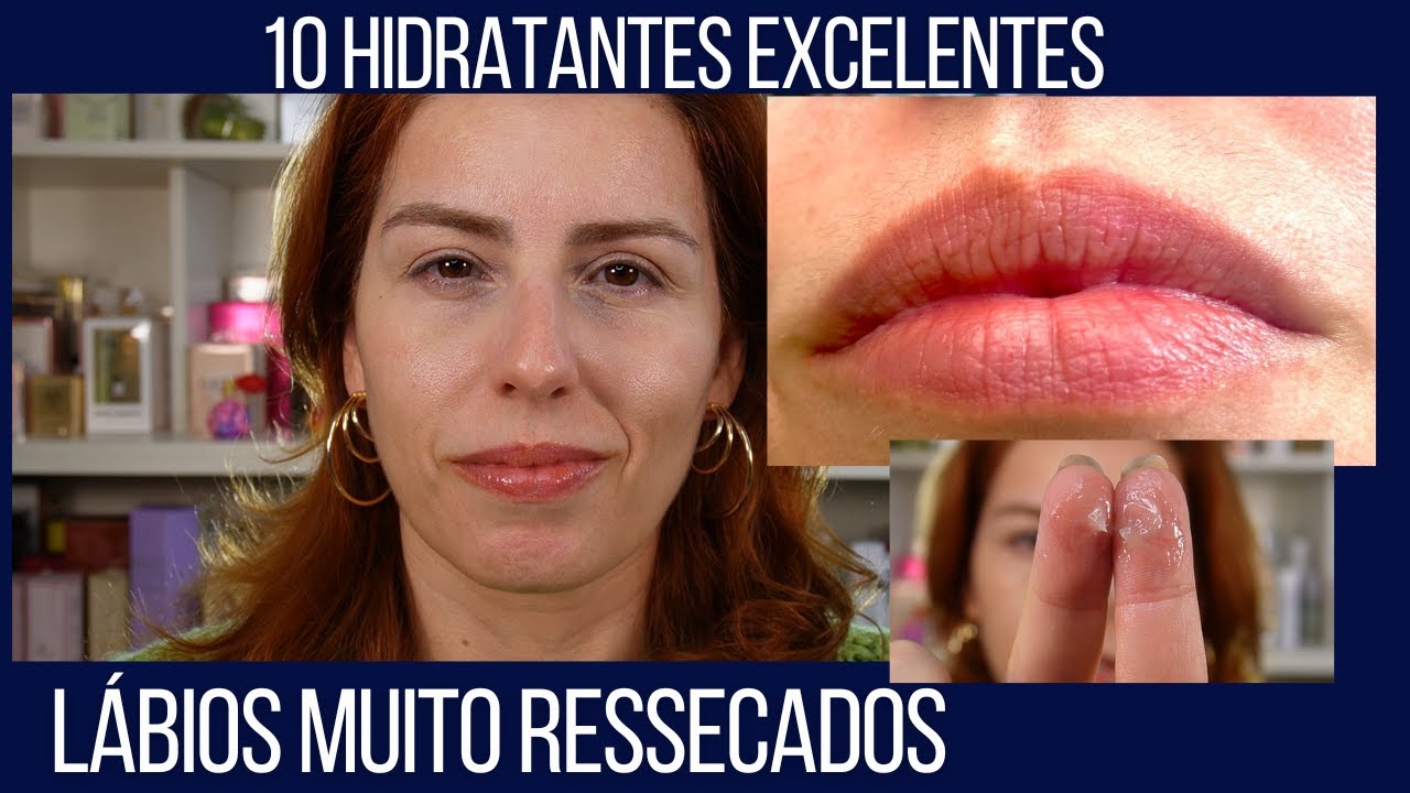 Lábios ressecados: 10 hidratantes para lábios MUITO ressecados (por Roacutan, ácidos)