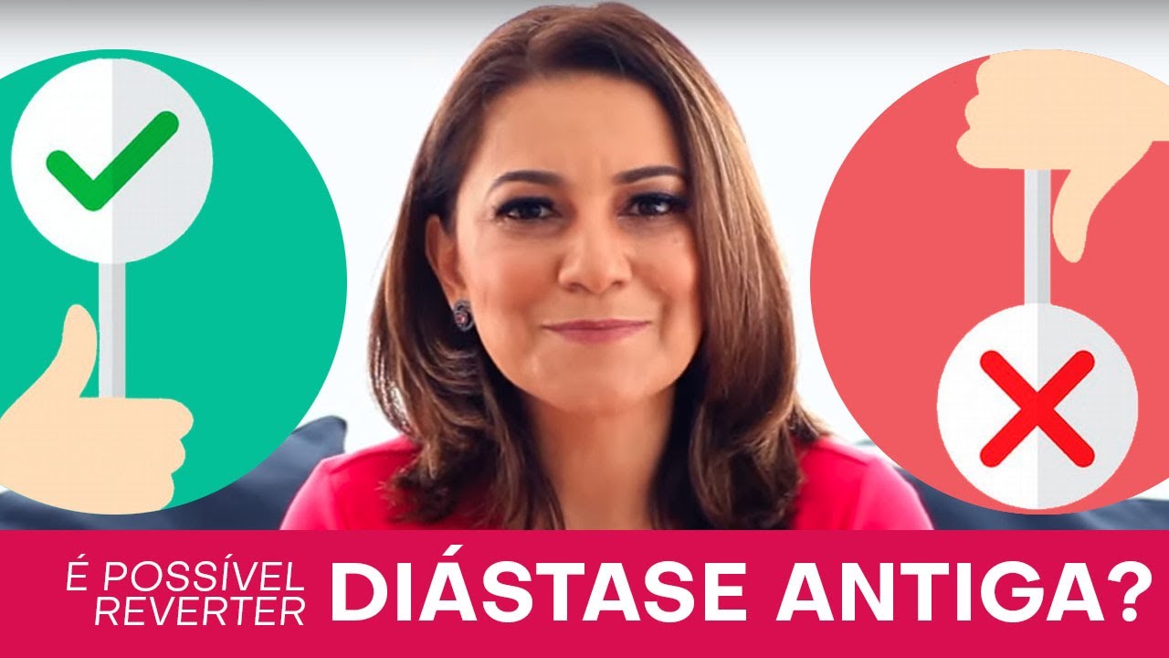 Consigo reverter a diástase depois de anos da gravidez?