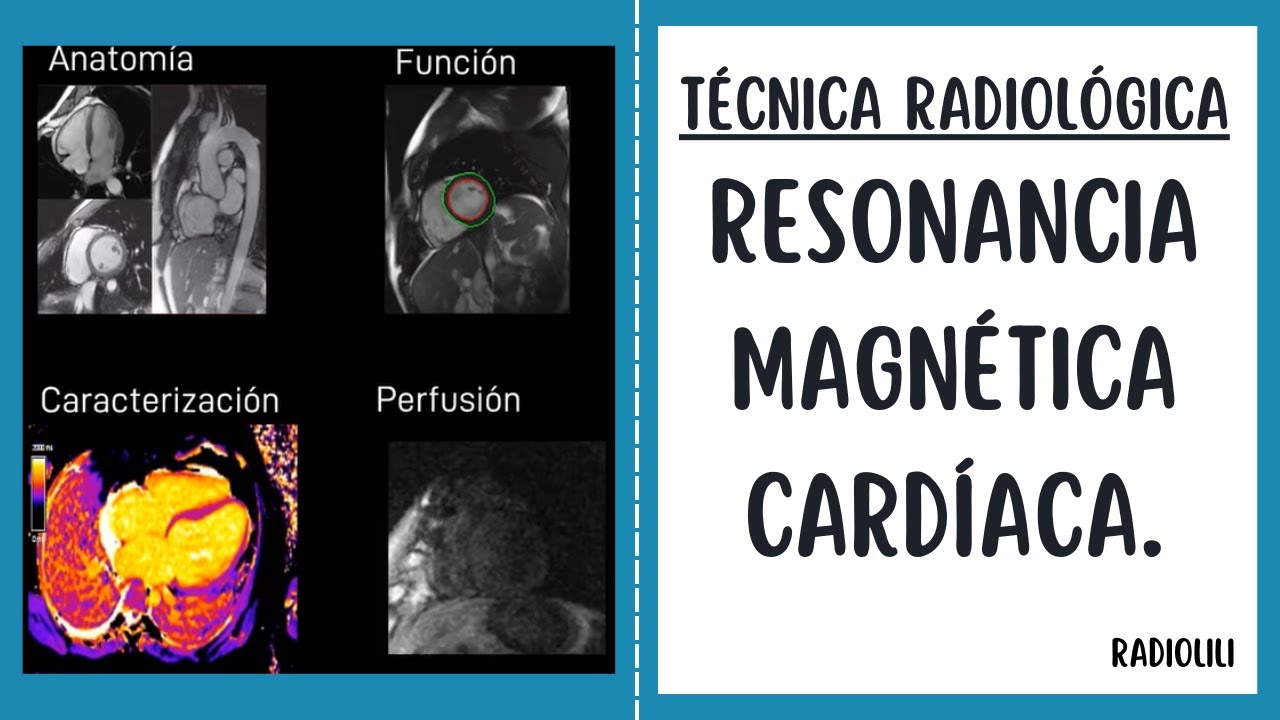 Resonancia Magnética Cardíaca: Técnica Radiológica.