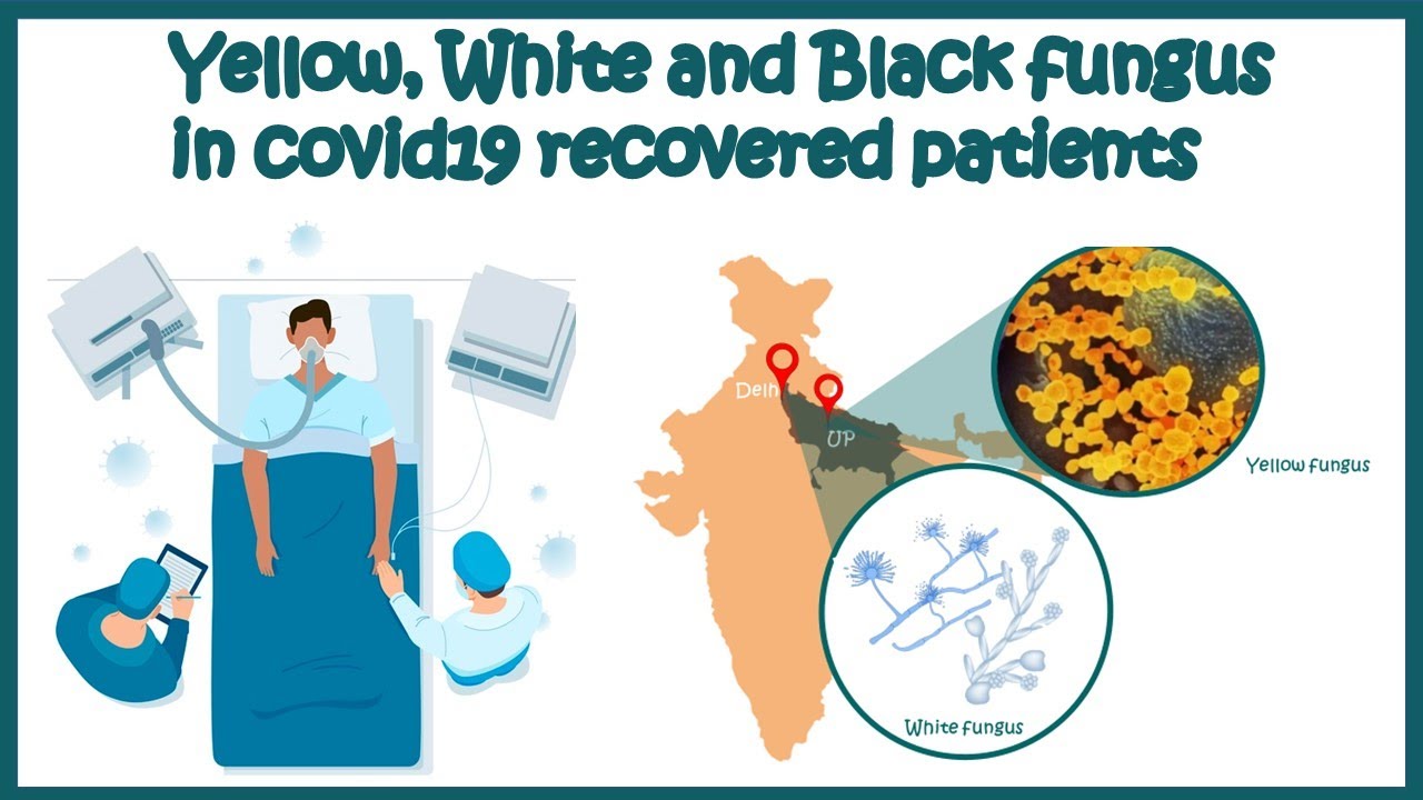 Yellow fungus disease/White & Black fungus disease || Risk of fungal disease associated with Covid19