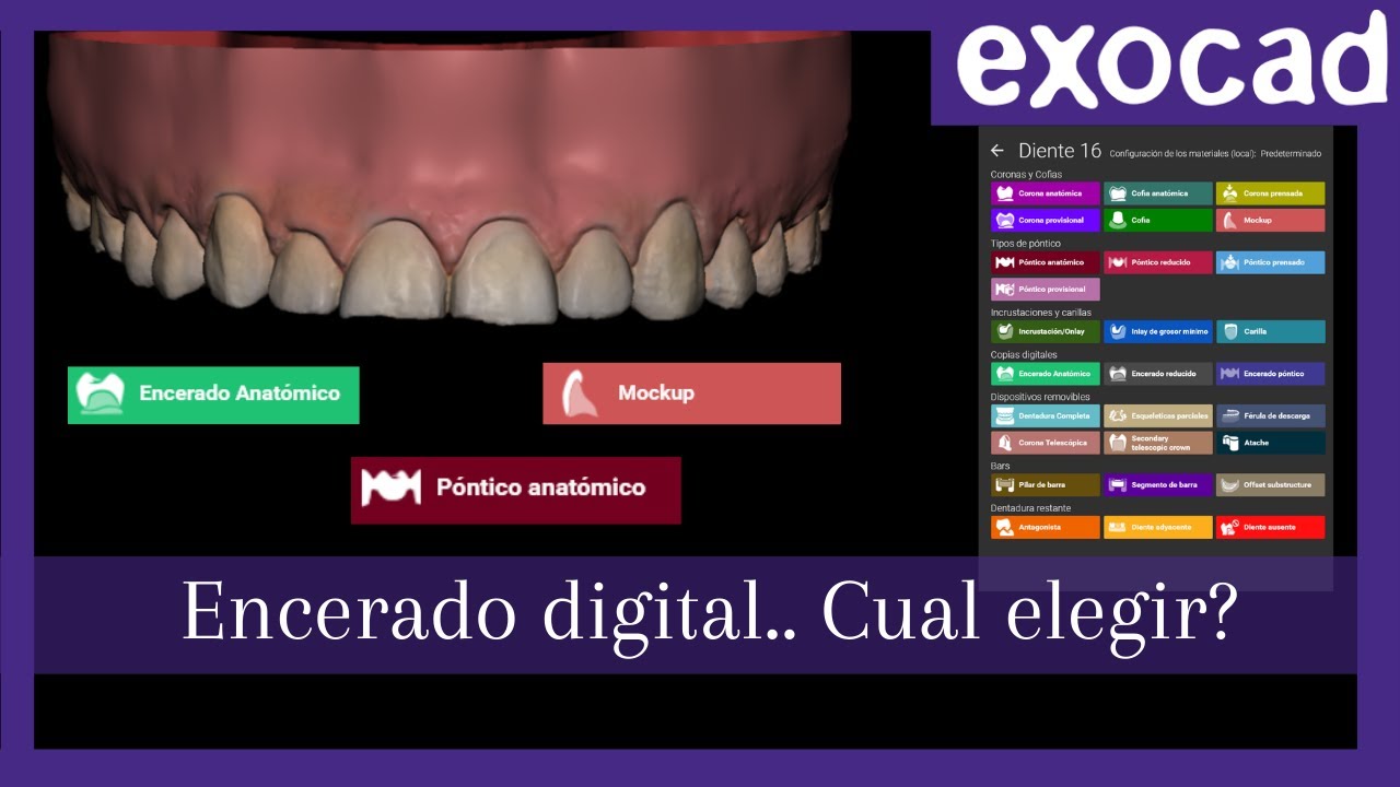 Cuál es la mejor opcion en dentaldb para realizar encerados digitales?