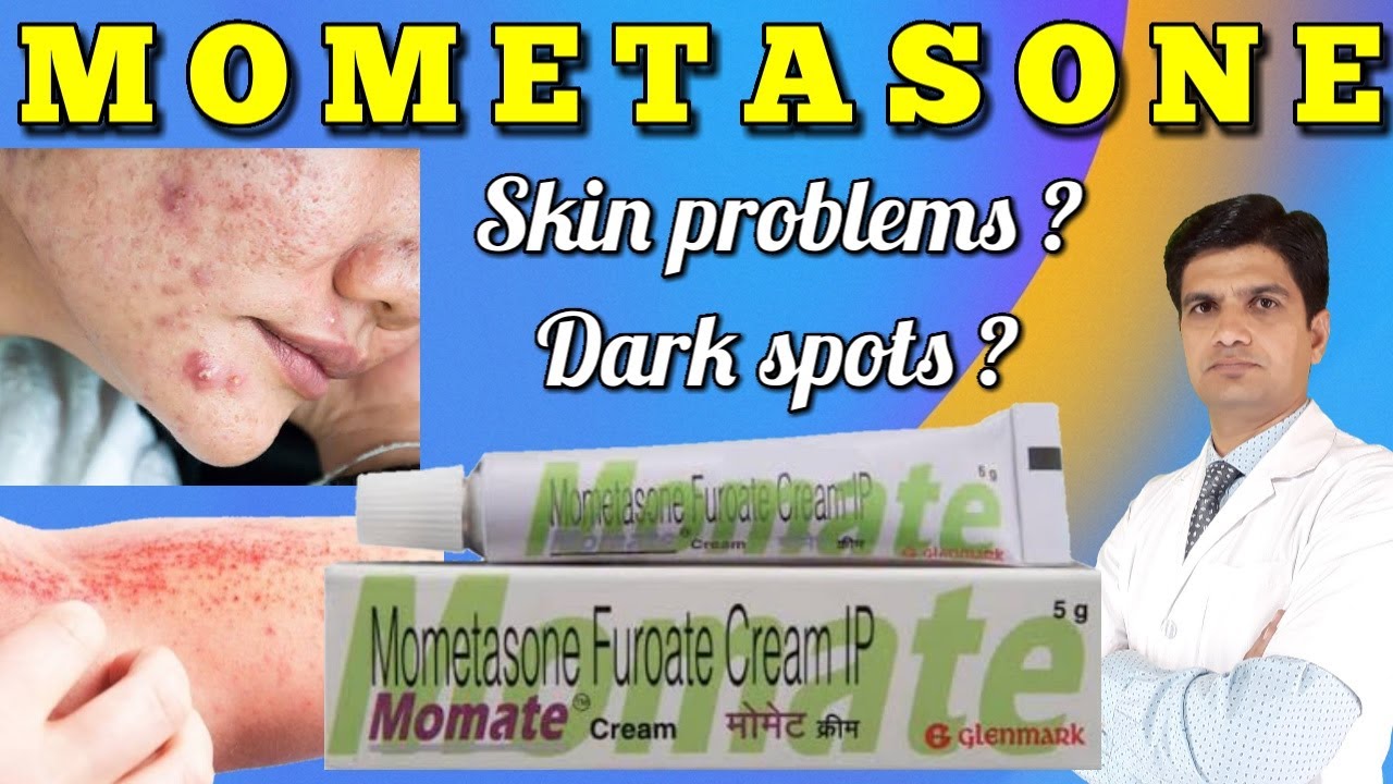 Momate cream | Mometasone | Mometasone furoate | Mometasone furoate cream