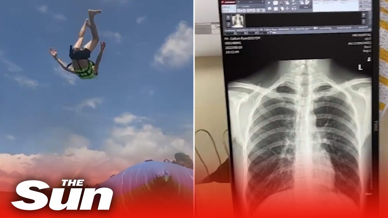 Horror moment man 'punctures lung' after inflatable ride accident #shorts