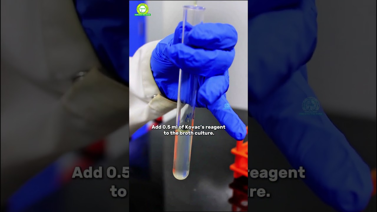 Indole Test in Microbiology | Clear Explain | Science Experiments | Chemistry @tamilnadutesthouse