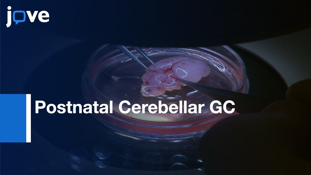 Postnatal Cerebellar GC Migration Imaging by Confocal Macroscopy | Protocol Preview